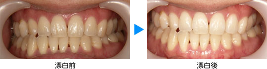 審美歯科・ホワイトニング
